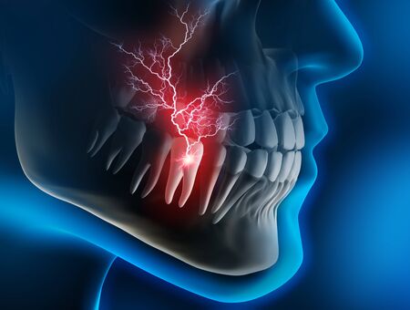 Closeup of a painful molar in jawの写真素材