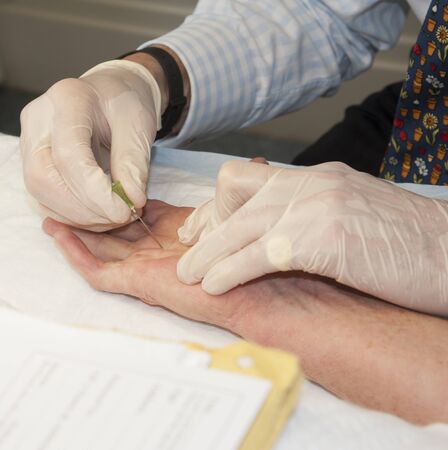Dupuvtrens contracture treatmentの写真素材