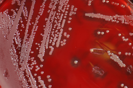Bacterial colonies growing on culture of sheep's bloodの写真素材