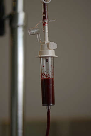 a valve on a blood transfusion line helps to control the rate of flowの写真素材