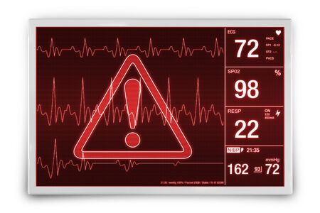 Heart Rate Alarm. Medical Device Isolated on White Concept Illustration.の写真素材