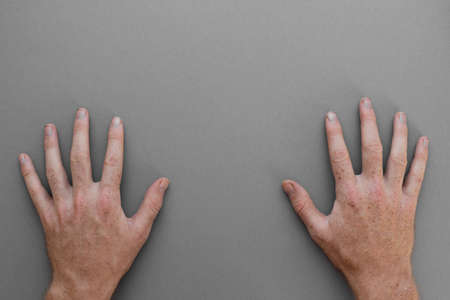 Two hands of a man lying palms down on the backgroundの写真素材