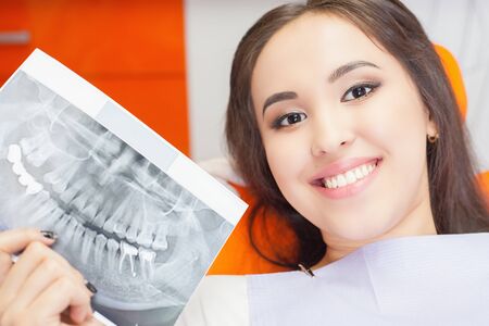 Patient beautiful girl holding x-ray picture of her teeth. Bad teeth affected by caries, require replacement by new implants, implantの写真素材