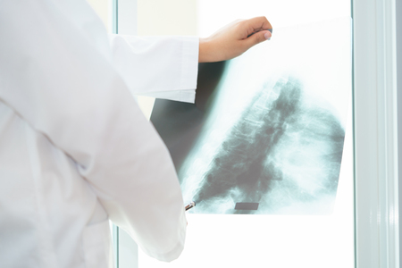 Female doctor examining about lungs with x-ray film - sick conceptの写真素材
