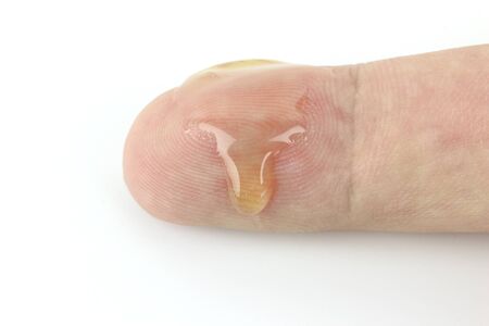 Honey on finger