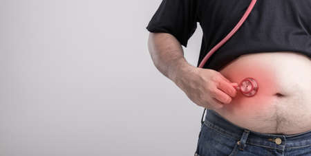 Medical Check up concept : Fat people holding red doctor stethoscope for check his health and body....