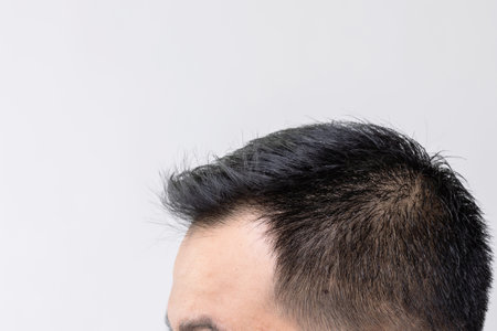 Portrait Asian man with worry feeling and touching on his head to show bald head or Glabrous problem. Studio shoot with copy space with grey backgroundの写真素材