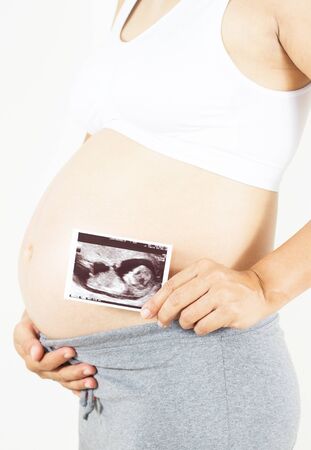 pregnant woman holding the digital echography photograph of her baby in front of her belly, soft focusの写真素材