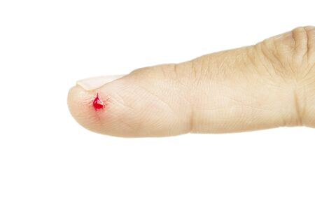 Wounds of knife  on the index finger asian. Fresh wound.の写真素材