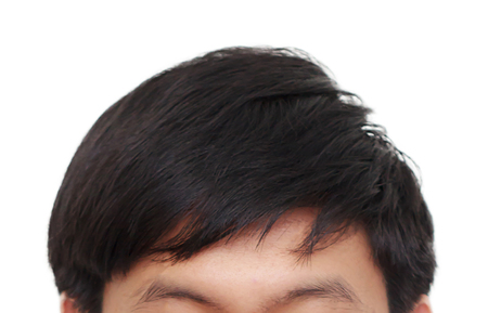Male head with black hair symptoms front sideの写真素材