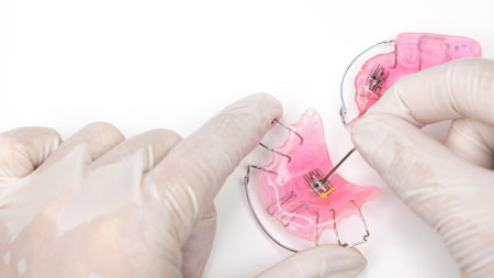 Doctors hands are demonstrating a device to widen the teeth, removable braces for children with distorted teeth.の写真素材