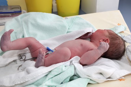 Newborn baby on table at hospitalの写真素材