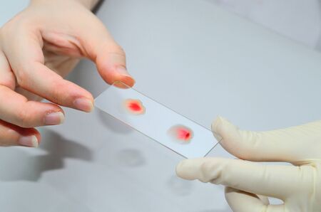 blood testing in laboratory