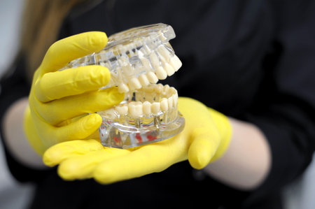 Hands in yellow gloves hold a false jaw Dentist on a mockup Close up, copy space Dentist demonstrates problems with teeth on the example of the layout of the jawの写真素材