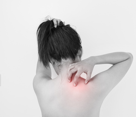 Women scratching the itch on shoulder, Healthcare and medicine concept.の写真素材