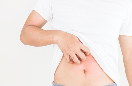 Young man scratch the itch on him belly, Healthcare concept.