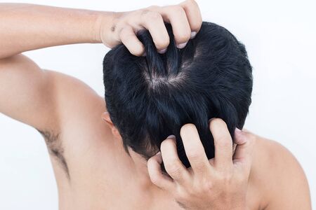 Young man suffering from itching her head, Itching scalp.の写真素材