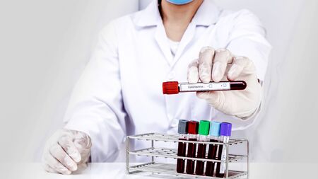 Hand of laboratory technician holding test tubes with blood, positive result of patiens.