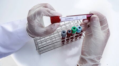 Hand of laboratory technician holding test tubes with blood, positive result of patients.の写真素材