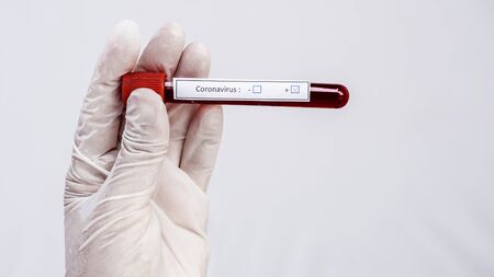 Hand of laboratory technician holding a test tube with blood, the result is positive.の写真素材
