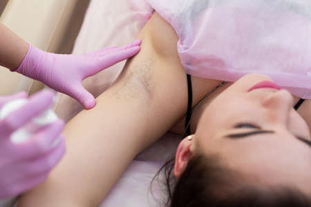 Close-up of armpit of a young girl with hair, hair removal procedure in a beauty salon. Beautician makes shugaring underarms for a young woman. Depilation of armpit with sugar paste.の写真素材