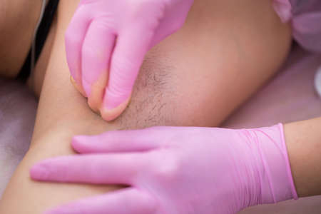 master of sugaring puts paste on the girls armpits. Professional woman at spa beauty salon doing epilation armpits using sugar. Sugaring.の写真素材