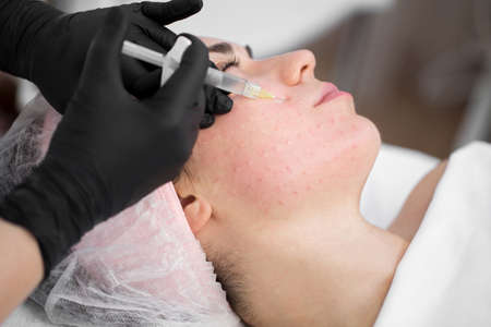 Close-up of cosmetologist makes the Rejuvenating facial injections procedure for tightening on the...