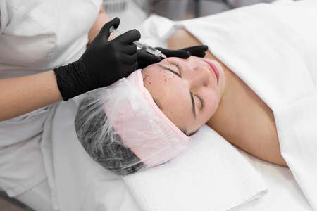 Closeup of cosmetologist doctor making anti-aging injections of a young girl. The beautician does the biorevitalization procedure on the face, blood from injections is visible on the skinの写真素材