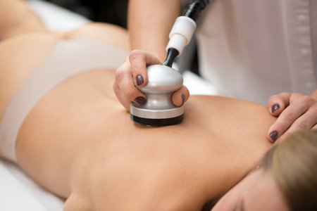 Vacuum roller massage. Hardware correction of the figure with the help of equipment equipped with a vacuum-roller manipulator. Massage of the back.の写真素材