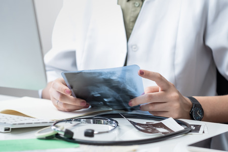 Female physician at modern medical doctor office. Woman examining x-ray at workplace in front of a desktop computerの写真素材