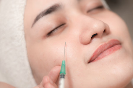 Woman needle injection facelift. Medical Filler for face lifting remove wrinkles in facial spa skin care clinic process.の写真素材