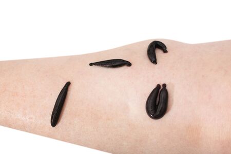 hirudotherapy, medical leech the suction blood ofの写真素材