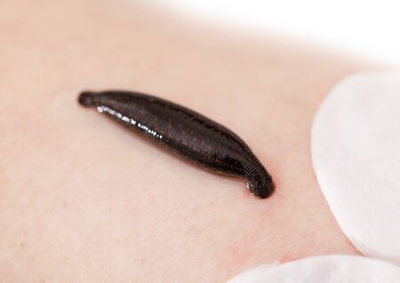 hirudotherapy, medical leech the suction blood ofの写真素材