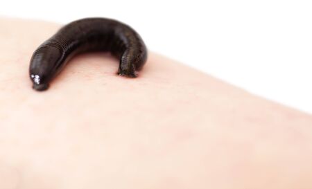 hirudotherapy, medical leech the suction blood ofの写真素材