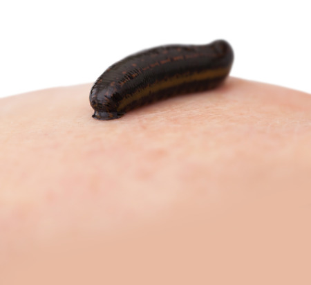 hirudotherapy, medical leech the suction blood ofの写真素材