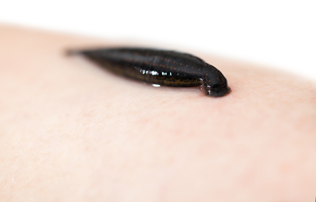 hirudotherapy, medical leech the suction blood ofの写真素材