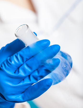 chemical reagent a test tube in the handの写真素材