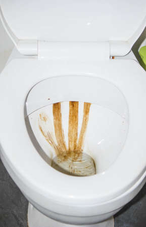 The toilet has dirty water stains attached to it due to the accumulation of unclean water.の写真素材