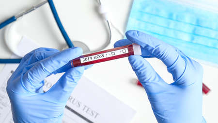 Nurse holding test tube with blood for 2019-nCoV analyzing. Novel Coronavirus blood test concept. Virus infection originatingの写真素材