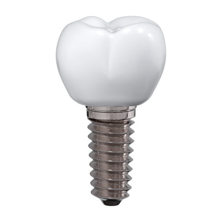 Prosthesis of a large molar in the form of an implant on a white background. Dental theme. 3d...