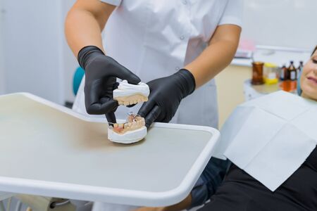 Prosthetics and dental treatment, model of the jaw in the hands of a dentist.の写真素材