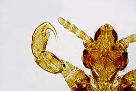 head liceの写真素材