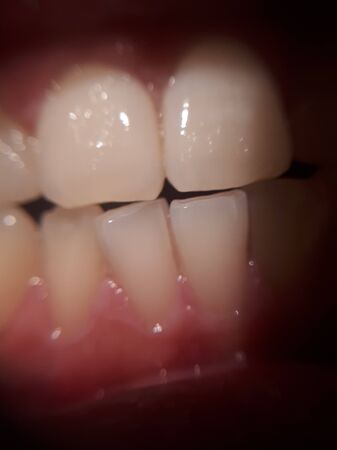 Curved teeth in a man's mouth. Macroの写真素材