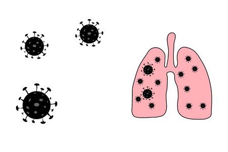 Sick lungs with covid-19 coronavirus. Virus Cells In Lung. Infected Lungs. Coronavirus, Covid-19. 2019-Ncov. Lung Disease
のイラスト素材