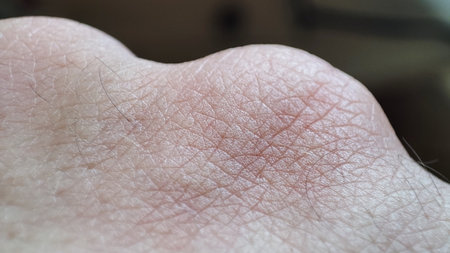 Clean pink skin texture surface macro. Medicine and dermatology concept. Details of human skin...