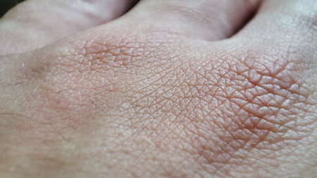 Clean pink skin texture surface macro. Medicine and dermatology concept. Details of human skin...