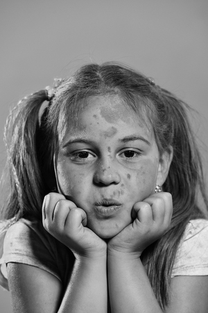 Kid with ponytails holds chin making faces.の写真素材