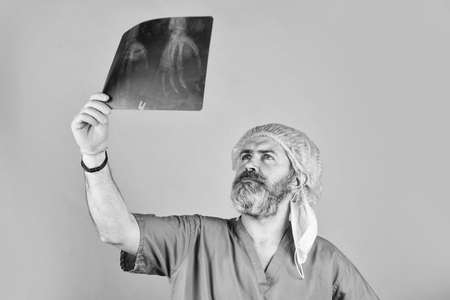 doctor examines radiographical snapshot. x-raying of hands. nurse checking x-ray film at hospital. health problems. Surgery operation and medical concept. man look at roentgen. Radiologist hold xrayの写真素材
