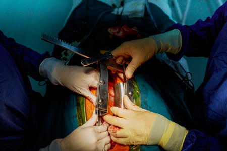 Using different surgical tools during the operation close-upの写真素材