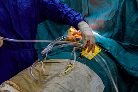 Nurse preparing the an undentified patient for the surgeryの写真素材